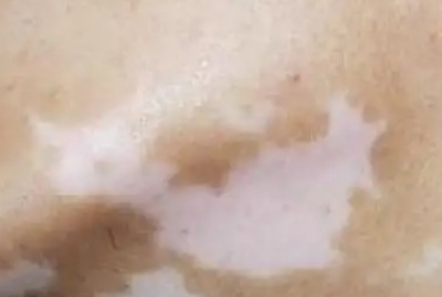 phpmPLZL0
