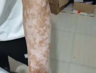 phpsXRiVd